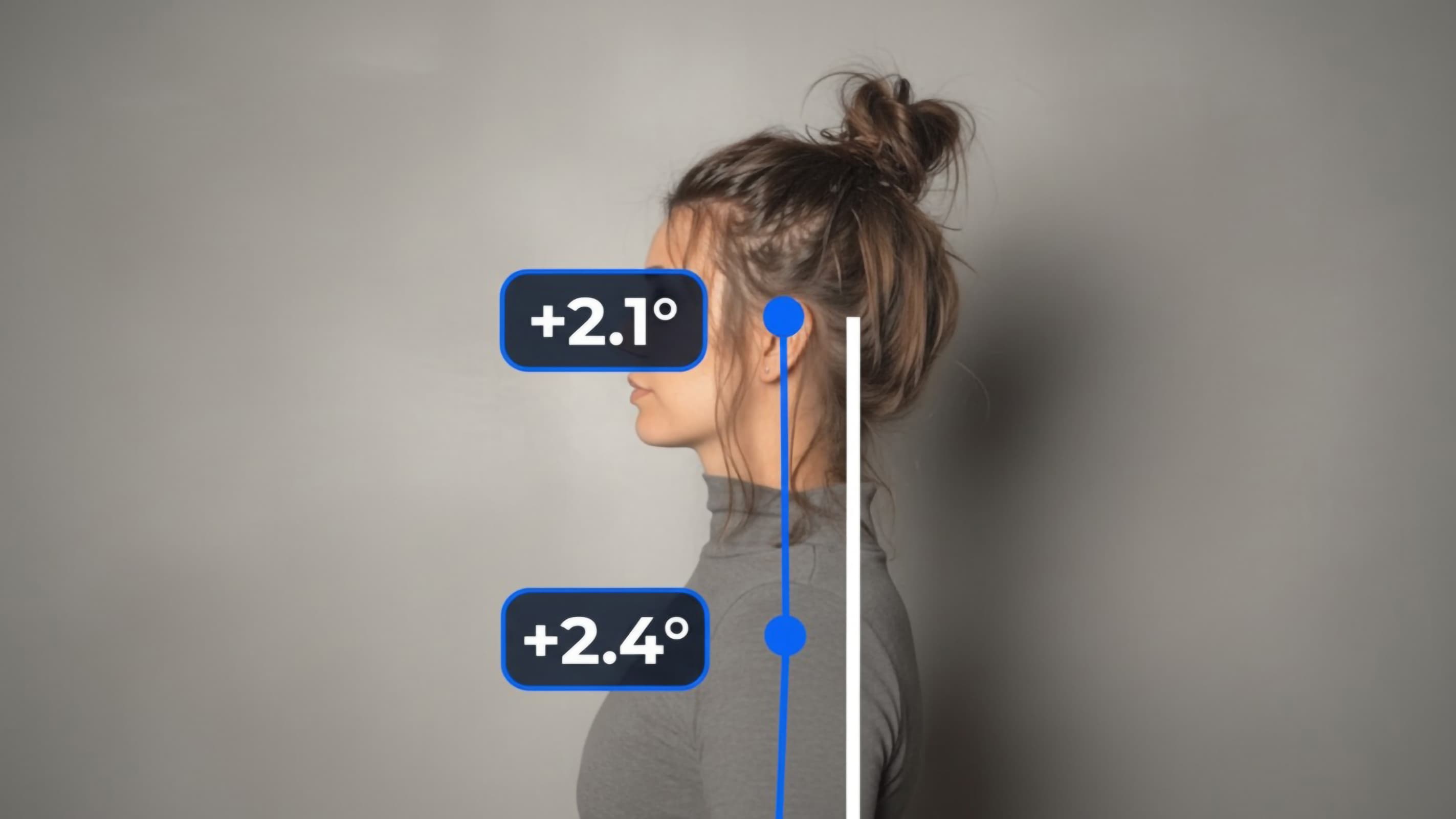 Side-view posture assessment showing head and upper-body alignment measurements generated using computer vision.